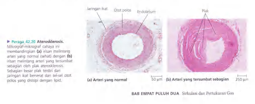 Ilustrasi Bab 42 - Sirkulasi dan Pertukaran Gas